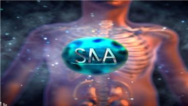 SMA tip1 hastalığı nedir?
